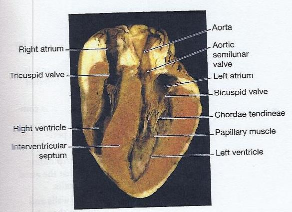 4. Identify the interventricular septum that divides the two ventricles. Notice how the inferior portion is thick and muscular, and the superior portion is thin and membranous. 5.