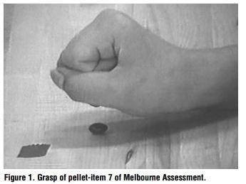 Results Means and standard deviations for the Melbourne Assessment before taping, immediately after taping, and 3 days of wearing the tape are presented in Table 3.