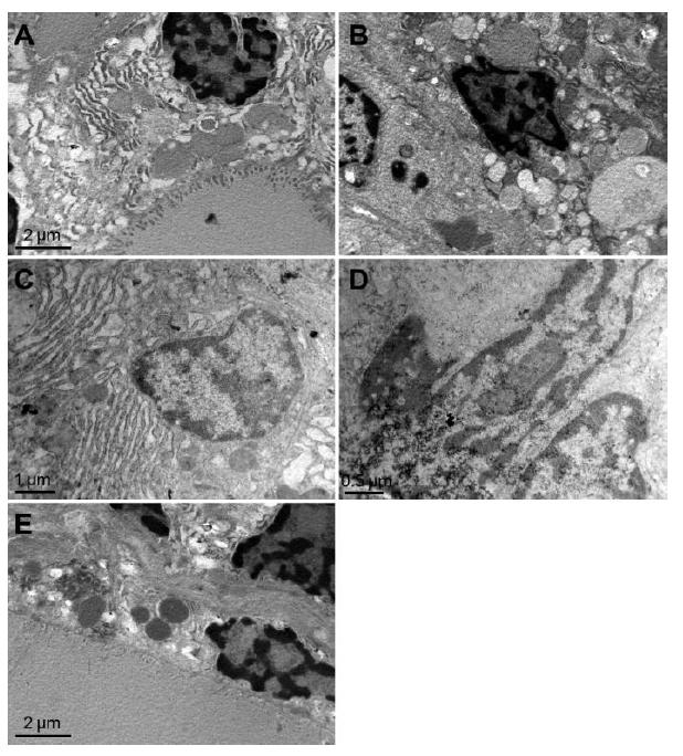 TEM imaging. No changes were observed in the NC group (A). Conspicuous cavitation and disappearance of mitochondrial cristae were observed in the AM group (B, C).