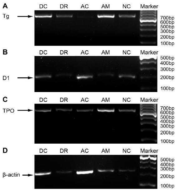 2319 Fig. 8. mrna expression of Tg, TPO, and D1 in the thyroid tissues. The mrna expression of Tg significantly increased whereas the expression of D1 decreased slightly in the AMT group.