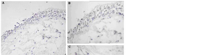 Figure 2 Photomicrographs representative of positive immunostaining of healthy bronchial biopsy sections with an A 1