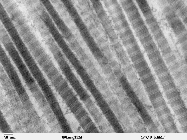 Collagen At the ultrastructural level each
