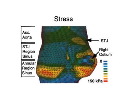 Figure 4.12: Stresses in the different aortic regions reported from Grande et al. study[54] Differences within sinuses circumferential stress values were also observable in this study.