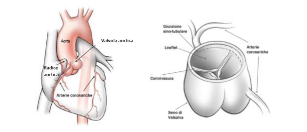 1.2 Anatomy and physiology of the aortic root The aortic root is the functional-anatomical unit that connects the left ventricle to the thoracic ascending aorta and that supports the constitutive