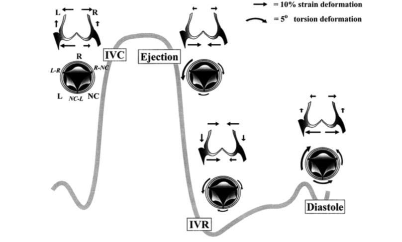Figure 2.7: deformations of the right (R), left (L) and non-coronary (NC) sector of the aortic root base.