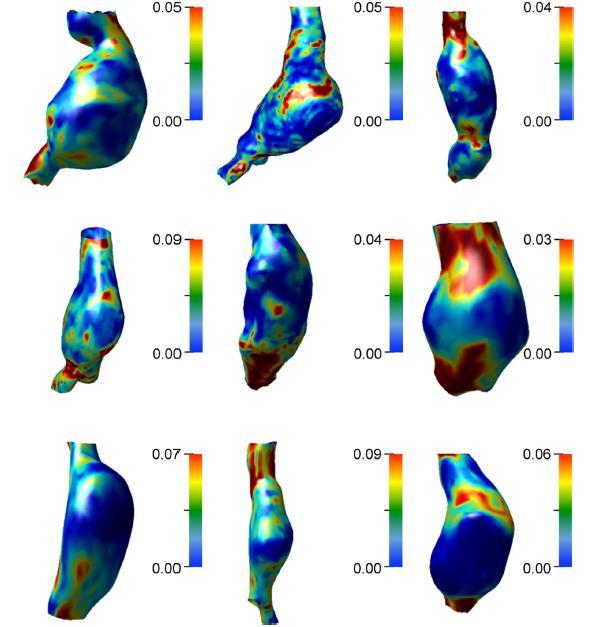 Figure 2.11: Colormaps of the first Green-Lagrange strain measured on the AAA wall for each patient at peak systolic pressure obtained from Satriano et al. In the work of Bellacosa et al.