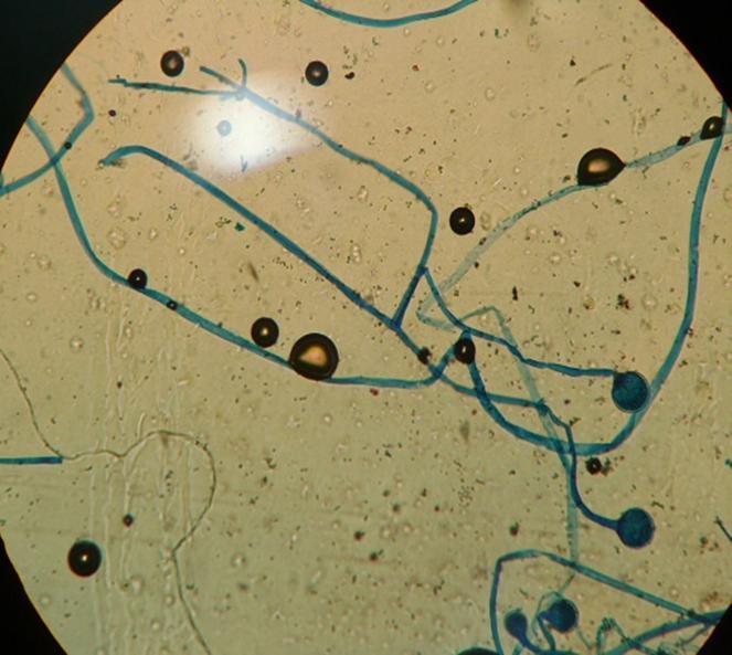 Fungal hyphae with sporangia from