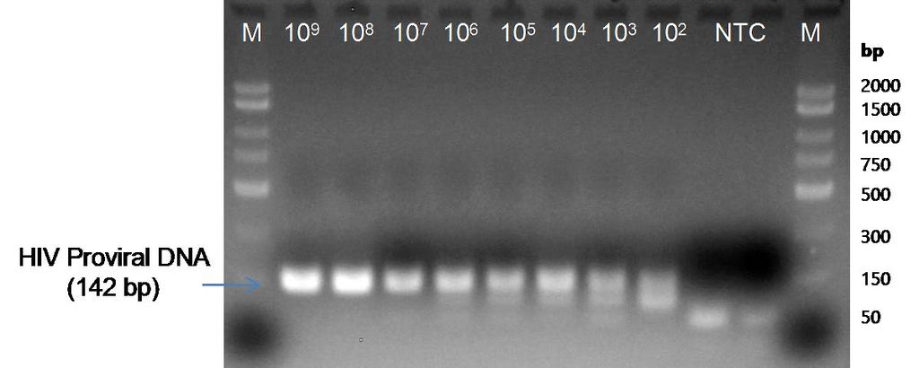 Figure 1: A representative 1X TAE, 1.4 % agarose gel showing the amplification of HIV Proviral DNA at different concentrations.