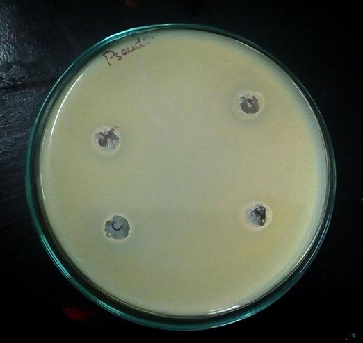 aureus Figure 5: Antibacterial Activity against Ps.
