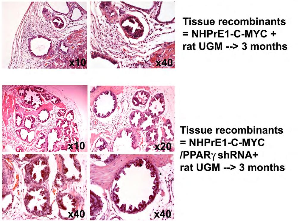 In order to investigate whether overexpression of c-myc resulted in carcinogenesis in these cells we introduced the C7-Myc construct and generated tissue recombinants using rugm. Figure 2.