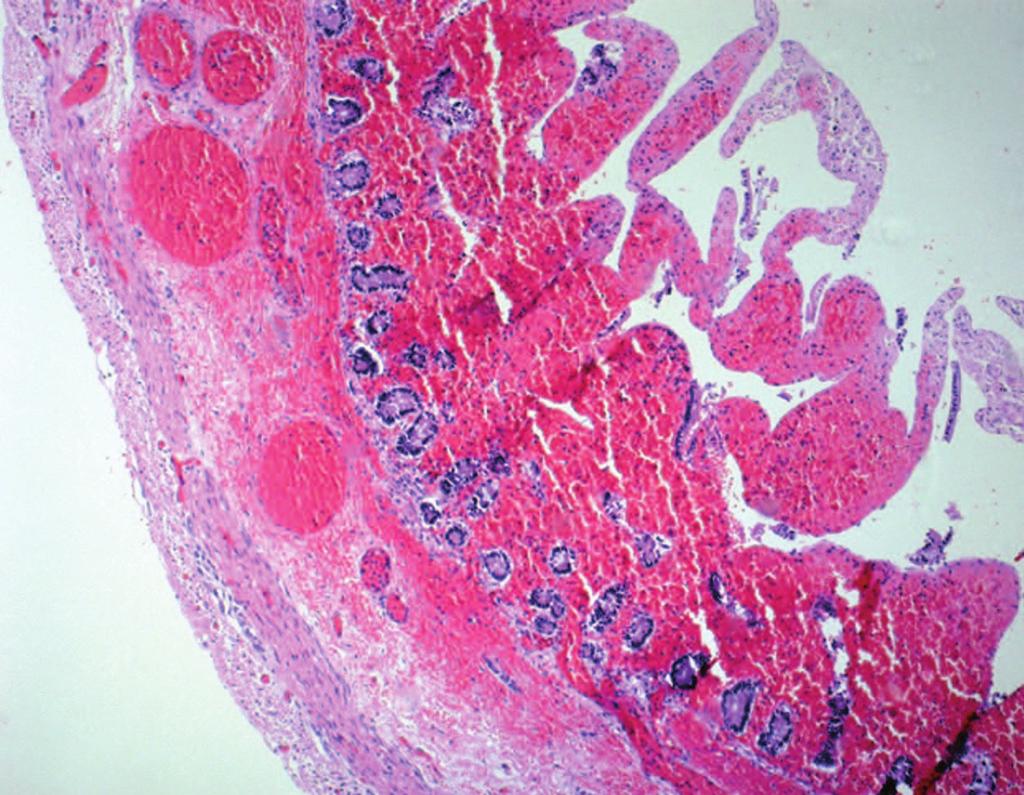 11 Histopathology (low power view): severe acute congestion and