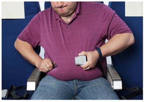 The Impact of Obesity Causes practical, everyday problems reduces physical activity causes