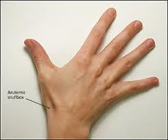 Exam I: mild swelling over anatomical snuffbox P: Tenderness over scaphoid bone R: Limited wrist and