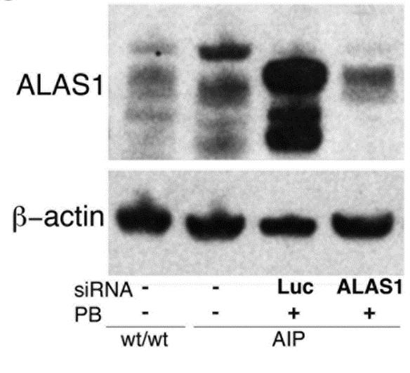 sirna Inhibits Induction of ALAS-1 and ALA/PBG in Mouse AIP Model Control or ALAS-1 sirna 1.
