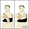 Asociated with: Rotator cuff tears Shoulder instabilities