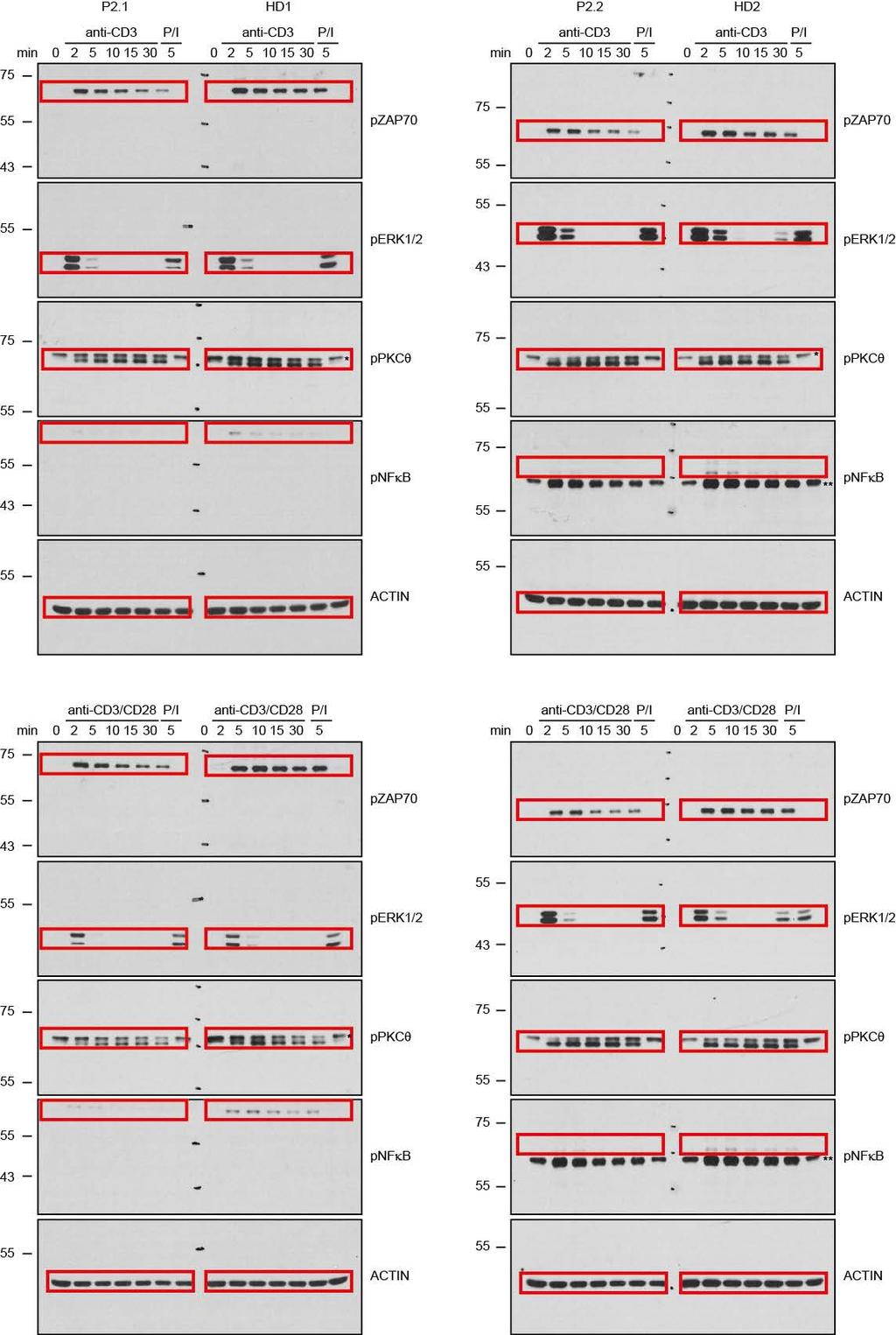 Supplementary Figure 9. Uncropped original immunoblots shown in Figure 7. The cropped areas are marked in red.