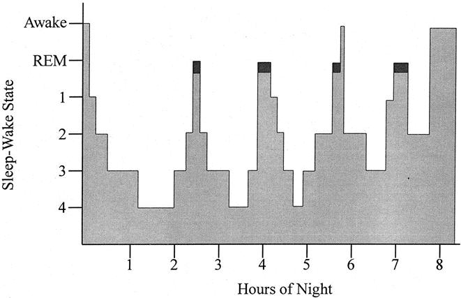 Rapid eye movement sleep Observed eye movements 20-25% total sleep time Body paralysis