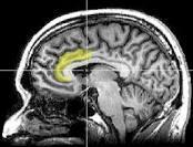 What s the Evidence Neuroplasticity MRI/MRF data Sustained increase in attentional and visceral awareness Anatomic changes in brain structure