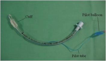 Endotracheal Intubation Placing an endotracheal tube can provide oxygenation, with the additional benefit of a cuff to reduce the risk of pulmonary aspiration.