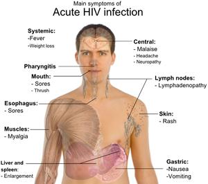 Stage 1: Primary HIV infection!
