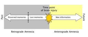 Amnesia Retrograde amnesia: memory loss for events prior to onset.