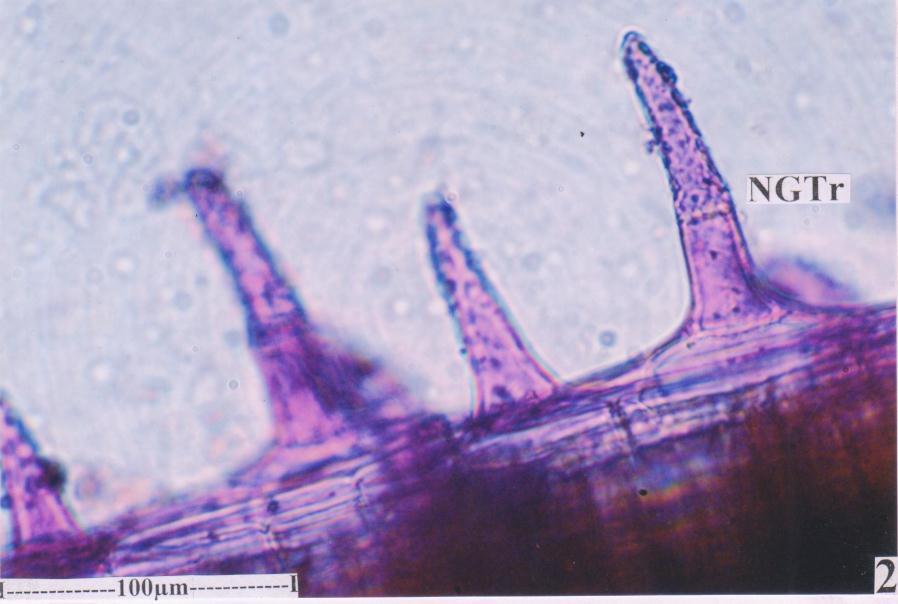 Figure 19: Non-glandular trichomes- in surface view in powder 
