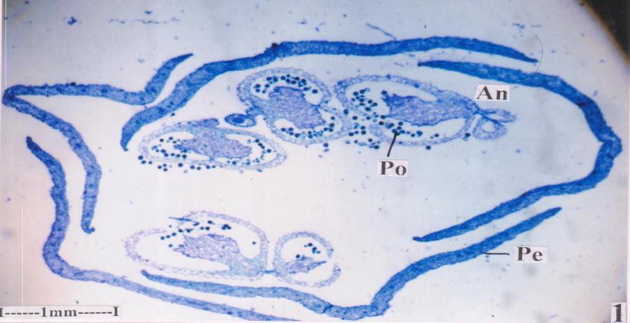 MT- Mesophyll Tissue, OEp-Outer Epidermis, Se - Sepal, St- Style).