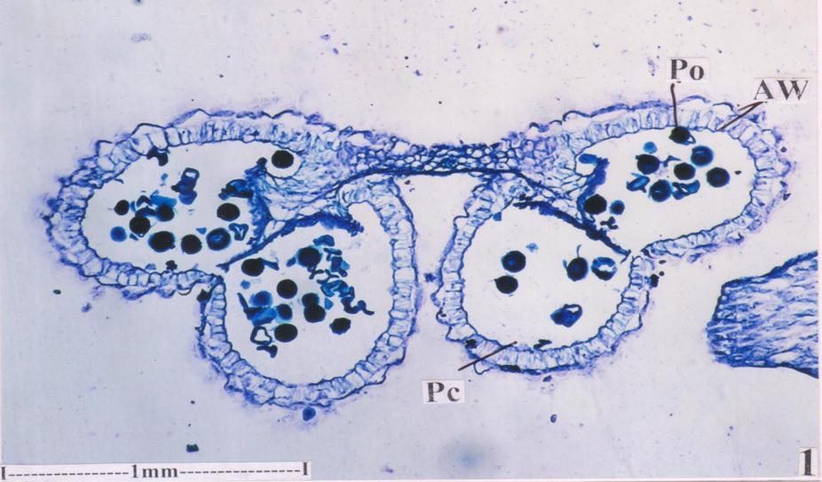 Figure 32: T.S of mature anther with pollen.