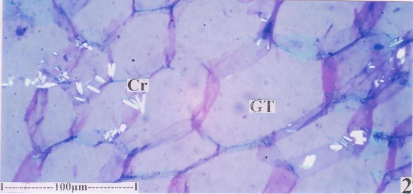 Figure 10: Calcium oxalate crystals in the central pith cells. Figure 11: T.S of lamina.