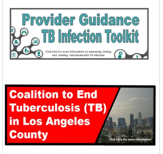 http://publichealth.lacounty.gov/tb/ Thank you! Join our Coalition! 28 jhigashi@ph.