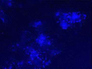 showing Fast Blue labeled neurons (vertical