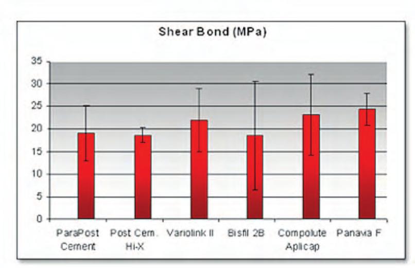 Comparison of carbon fiber and stainless steel root canal posts. Quintessence Int. 1996;27:93-7. 2. Vallittu PK, Sevelius C.