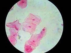 There are animal cells and plant cells that have similarities as well as