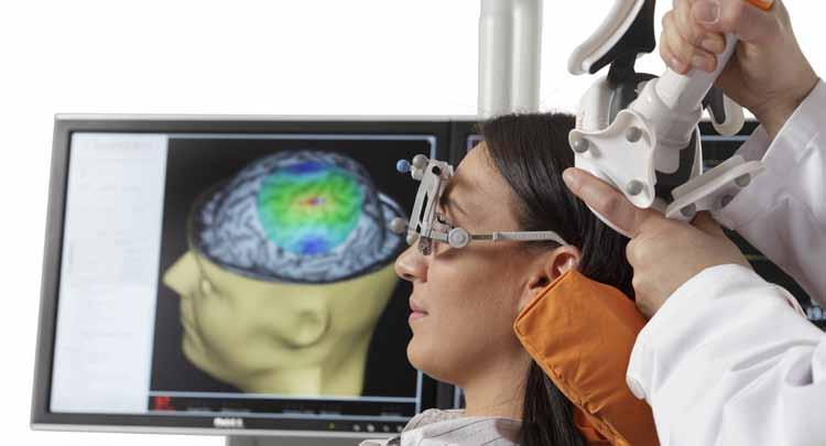 How it Works: The procedure allows your doctor to study your brain using transcranial magnetic stimulation (TMS). TMS uses a magnetic coil wand which will be touching your head.
