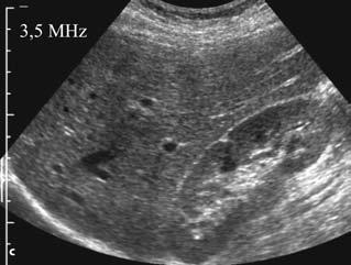 2 1 Basics of Ultrasound B-scan technique). One of the preconditions is that only a small part oftheultrasoundisreflectedateachinterface,andmostoftheultrasound is transmitted to deeper levels.