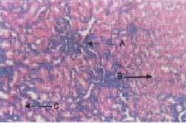 cells and necrosis of tubular epithelium was observed.