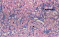 epithelium while vitamin E treated group showed extensive haemorrhage in cortical area.