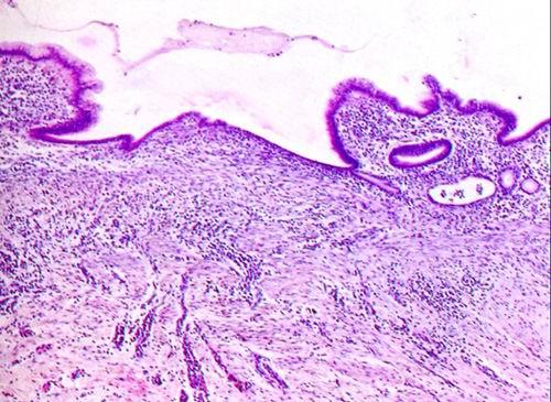 2 Glandular epithelial cells regeneration mucosal surface