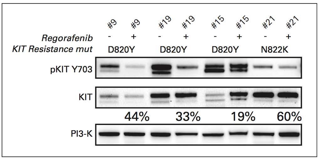 Therapeutic Selection TKI refractory setting Sunitinib - Inhibitory Activity Against ATP Binding Pocket Mutations Regorafenib Inhibitory Activity Against Activation Loop Kinase Mutations B