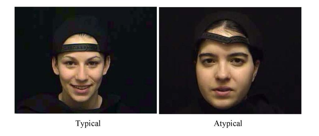 Figure 3. Examples of Typical and Atypical Female Faces The results for each age group are shown in Figure 4.