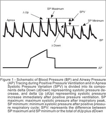 (PPV) Stroke volume variation (SVV) Bedside