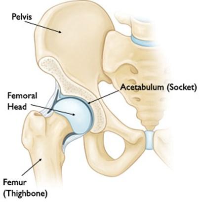 The aim of surgery is to change the position of the acetabulum to provide a better shaped socket for the femoral head to sit in and therefore improve the alignment of your hip joint.