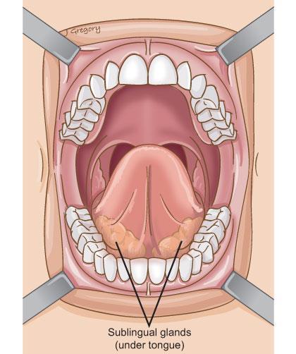 Sublingual Gland Lies under the tongue Covered by mucosa 8-20 small ducts which opens directly in oral cavity or with submandibular duct Mode of secretion: mostly mucus, with little serous
