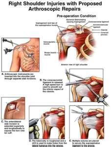 Understanding the Shoulder The shoulder is the most versatile joint in the human body. It has the widest range of motion, which means it can move in more directions than any other joint.