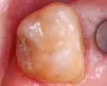 teeth. Clin Oral Investig.