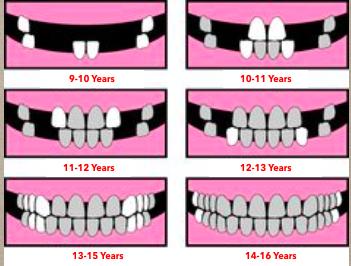 9-12 YEARS OLD Lower teeth erupt before the upper teeth Molars and lower incisors