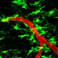 Activated microglial cells secrete a wide range of inflammatory factors, including reactive oxygen species, cytokines