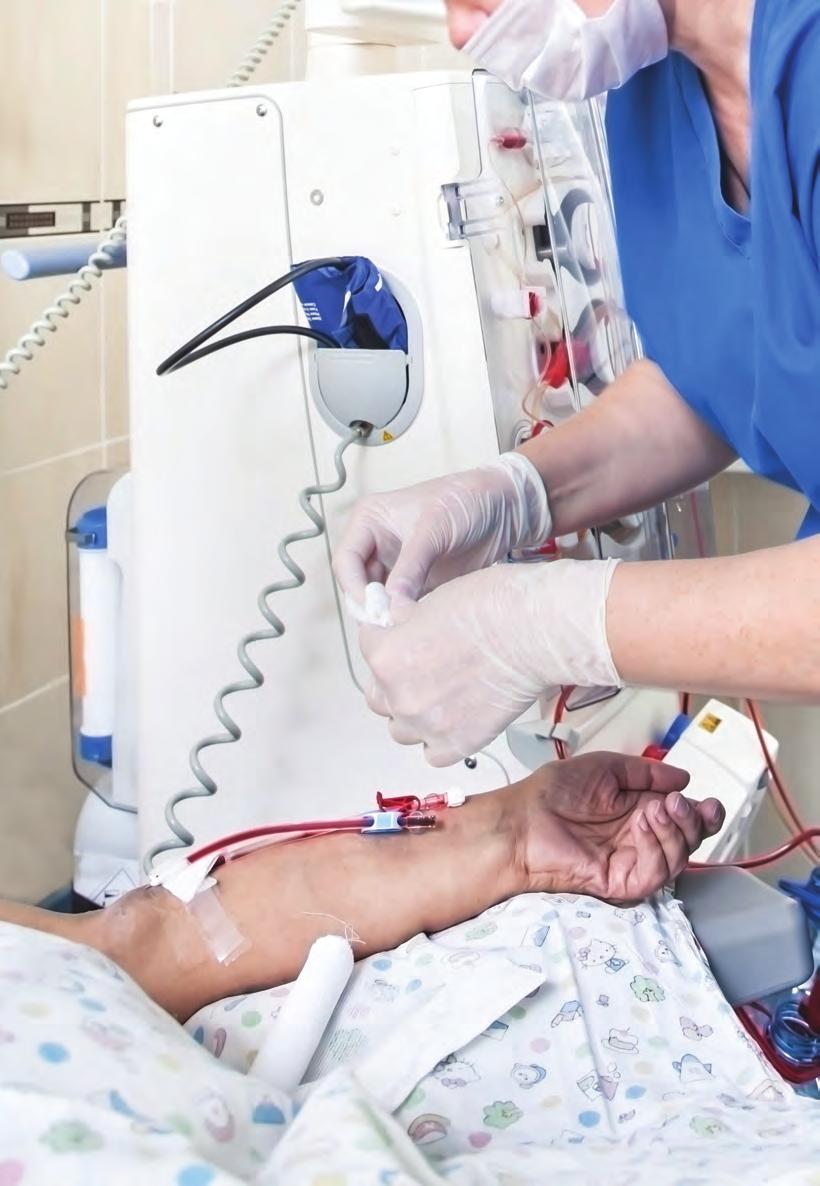 If you have CKD (chronic kidney disease) and have decided to receive hemodialysis (HD), you will need to have special access created to your veins.