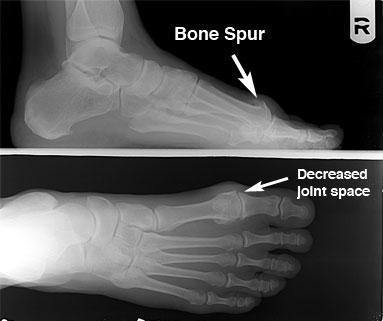 Weight bearing radiographs can offer critical information.