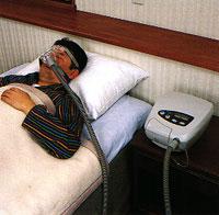 Treatment options In moderate to severe OSA + daytime sleepiness Nasal continuous positive airway pressure (CPAP) remains the most common treatment.